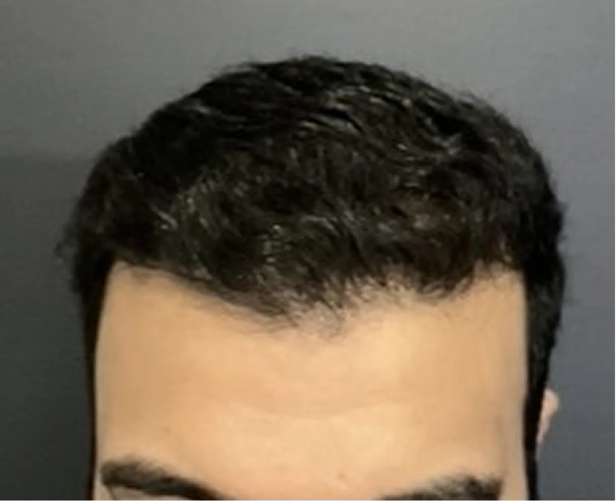 After Image