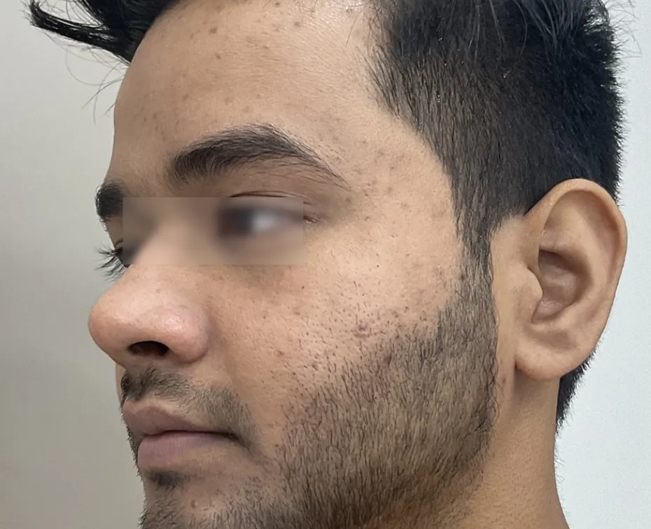 Before Image